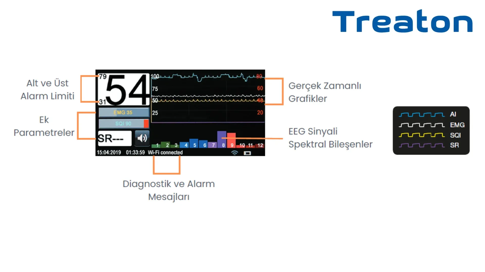 МГА-06 МОНИТОР ГЛУБИНЫ АНЕСТЕЗИИ (БИС МОНИТОР) 5