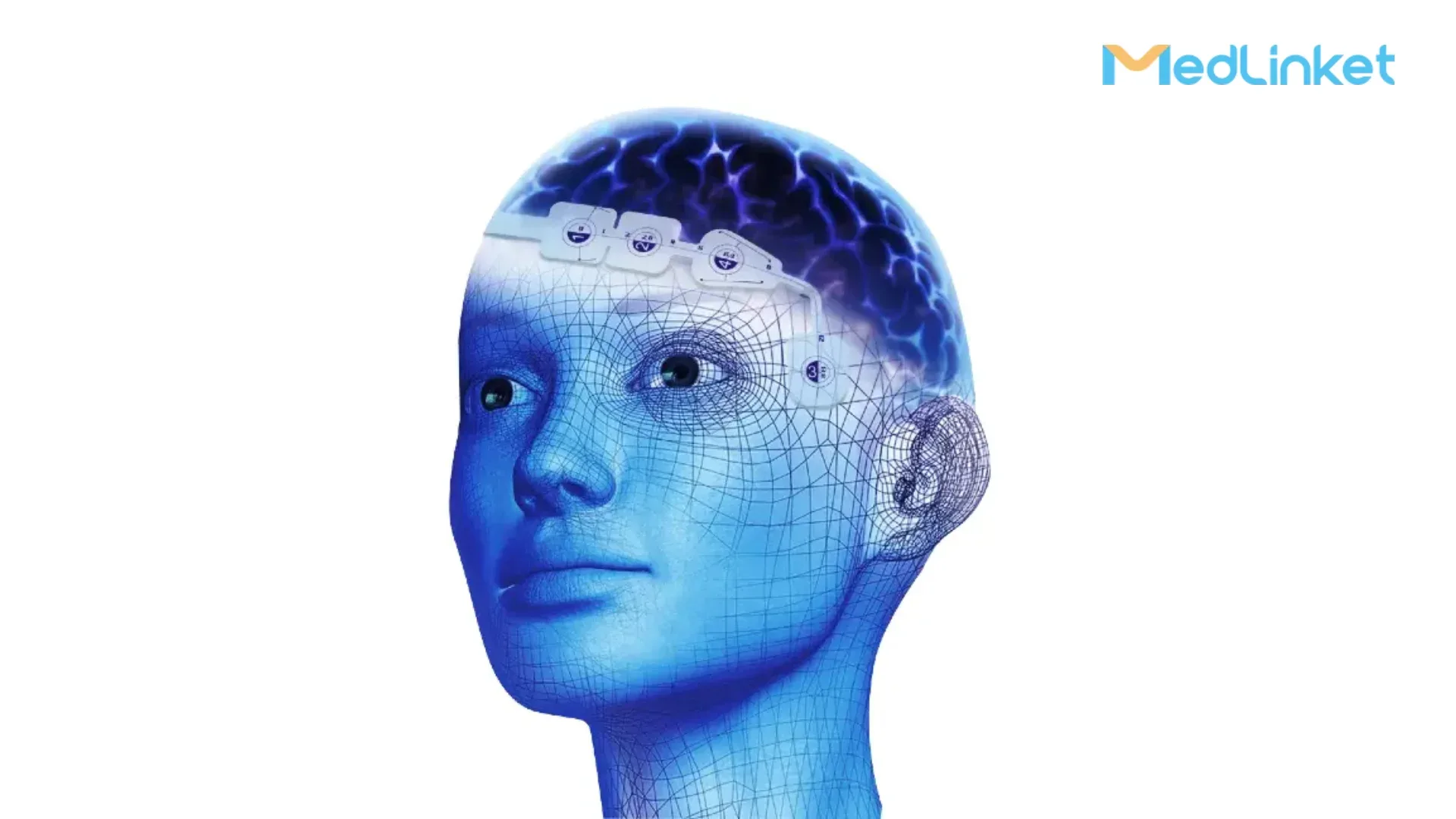 ПЕДИАТРИЧЕСКИЙ БИС-ЭЛЕКТРОД 3