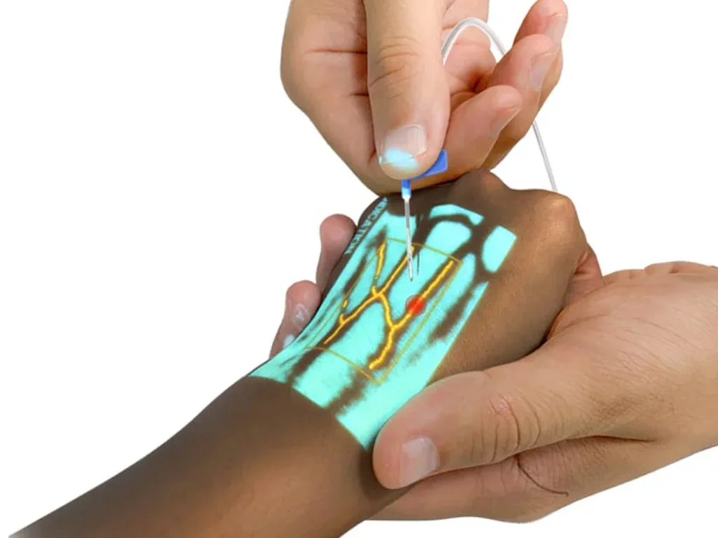 АППАРАТ ДЛЯ НОВОРОЖДЕННЫХ И ДЕТЕЙ VS-500 СОСУДИСТОЙ ВИЗУАЛИЗАЦИИ 4