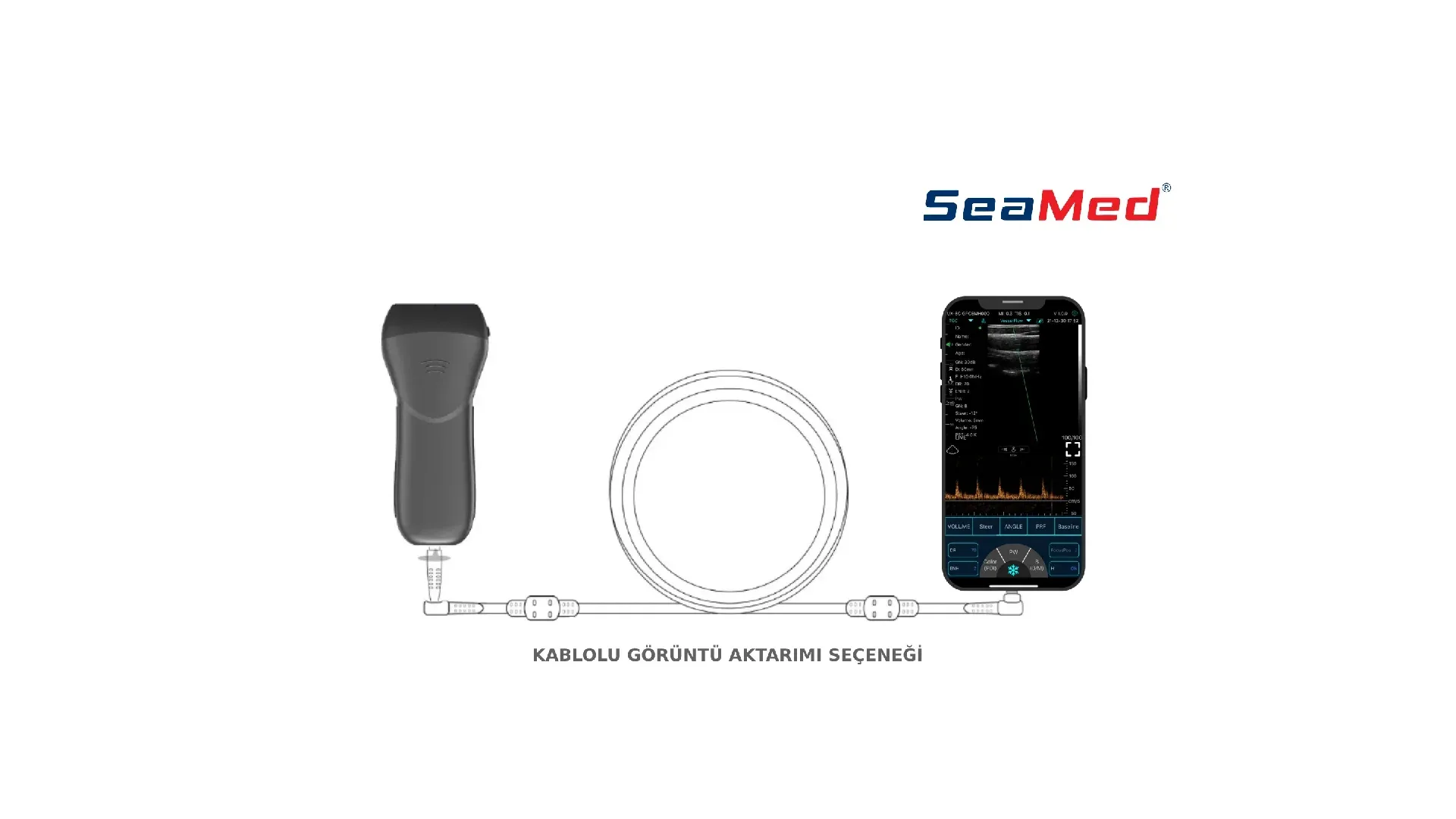 CONTED ЛИНЕЙНЫЙ РУЧНОЙ БЕСПРОВОДНОЙ УЛЬТРАЗВУК 4