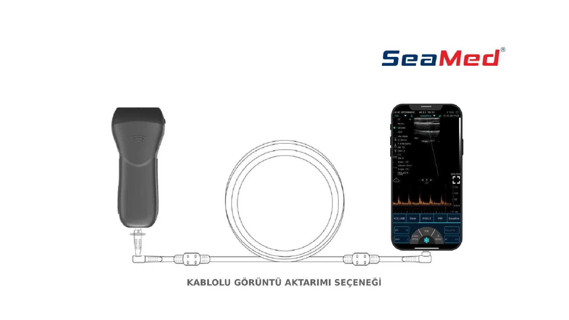 KONTED CONVEKS РУЧНОЙ БЕСПРОВОДНОЙ УЛЬТРАЗВУК 4