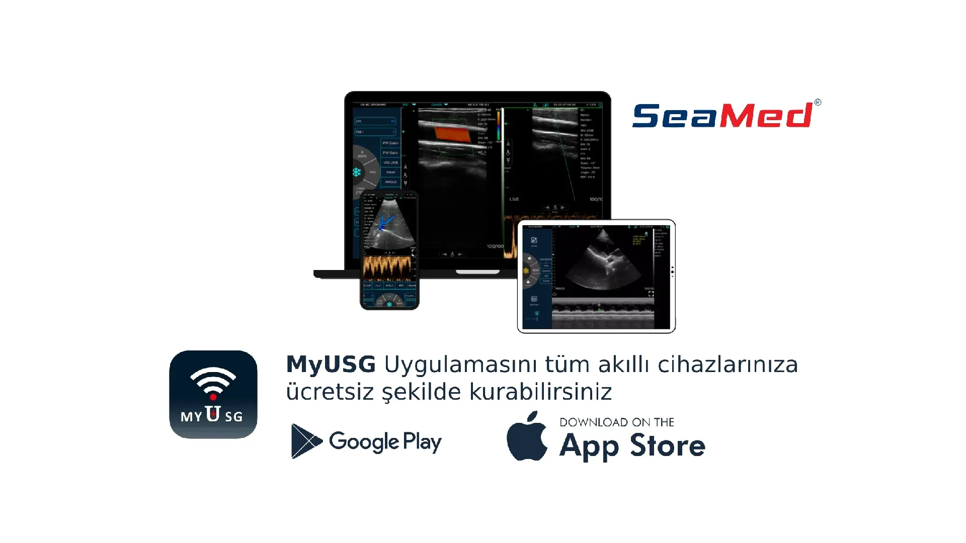 KONTED CONVEKS РУЧНОЙ БЕСПРОВОДНОЙ УЛЬТРАЗВУК 5