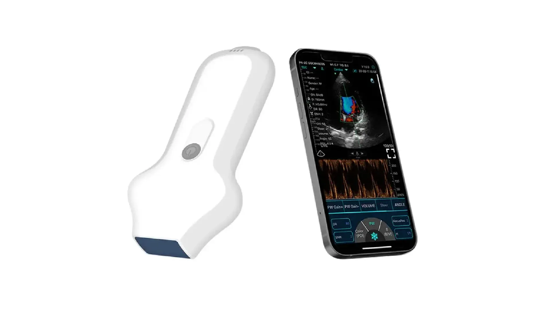 РУЧНОЕ БЕСПРОВОДНОЕ УЛЬТРАЗВУКОВОЕ СОЕДИНЕНИЕ СЕРДЦА CONTED 5