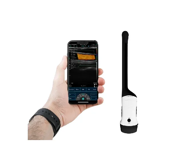 CONTED CONVEX + ТРАНСВАГИНАЛЬНОЕ РУЧНОЕ БЕСПРОВОДНОЕ УЛЬТРАЗВУК 4