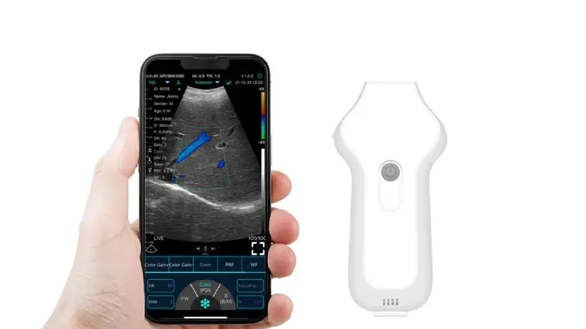 РУЧНОЕ БЕСПРОВОДНОЕ УЛЬТРАЗВУКОВОЕ СОЕДИНЕНИЕ СЕРДЦА CONTED 3