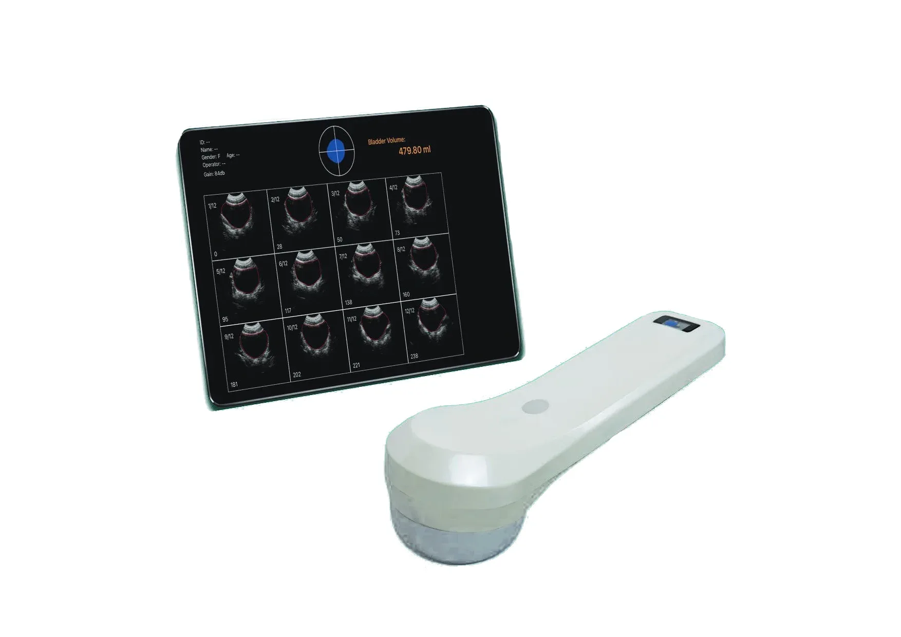 ЗОНД ДЛЯ ИЗМЕРЕНИЯ МОЧЕВОГО ПУЗЫРЯ KONTED C10P