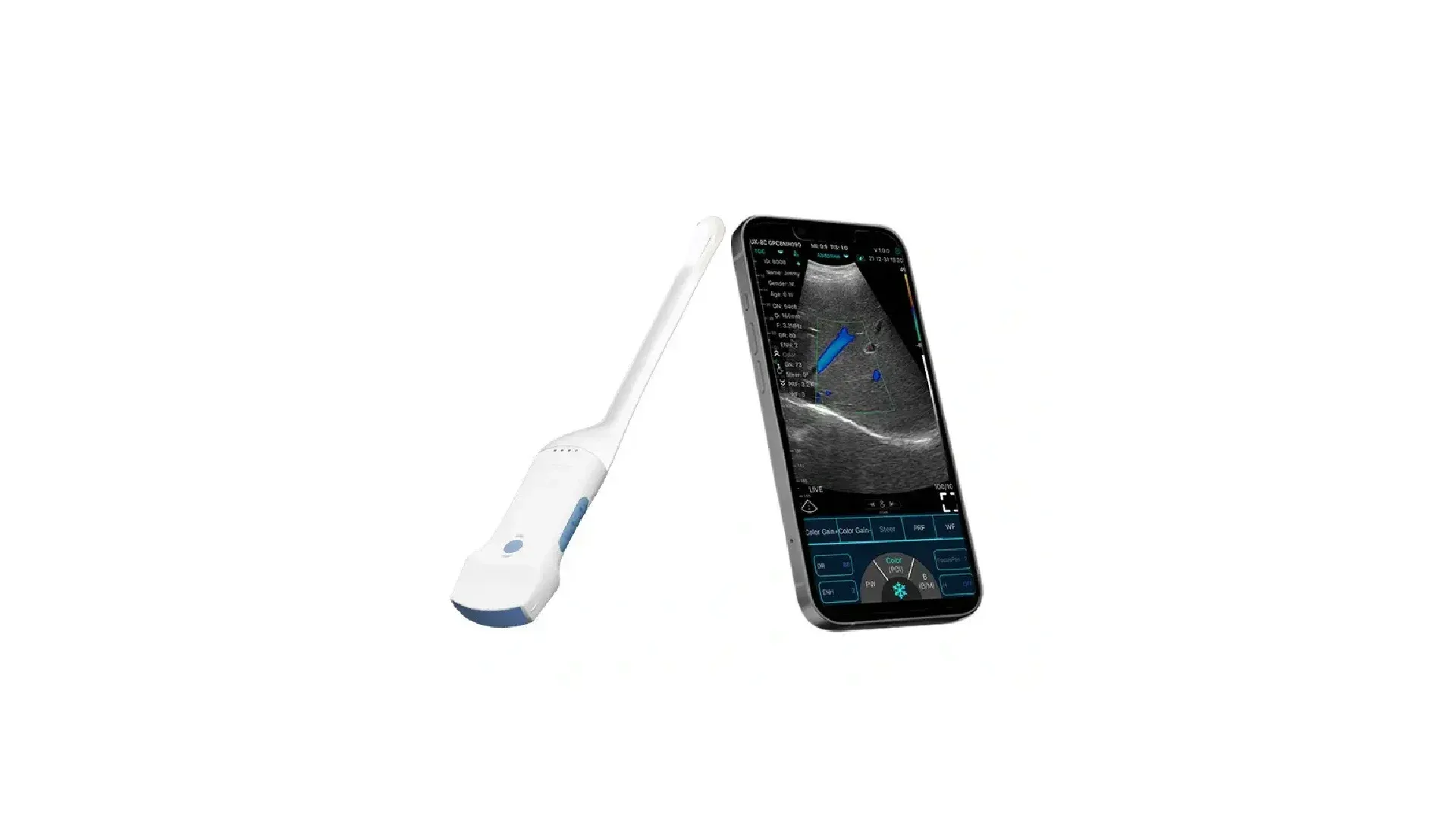 CONTED CONVEX + TRANSVAGINAL HAND-HOLD WIRELESS ULTRASOUND